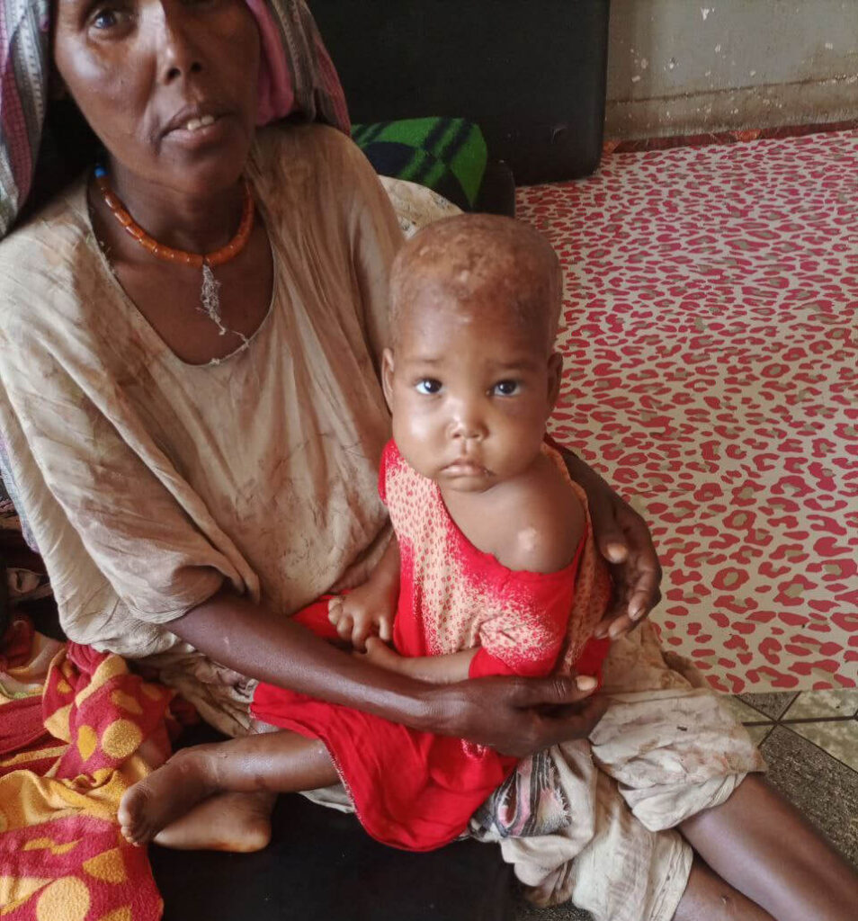 Kubra Jawar with her mother, Fatuma, during the admission process at Boko Health Center.