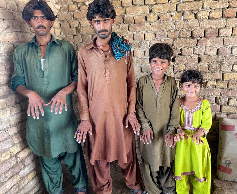 Villagers show their hands after recovering from skin disease, thanks to care from International Medical Corps.